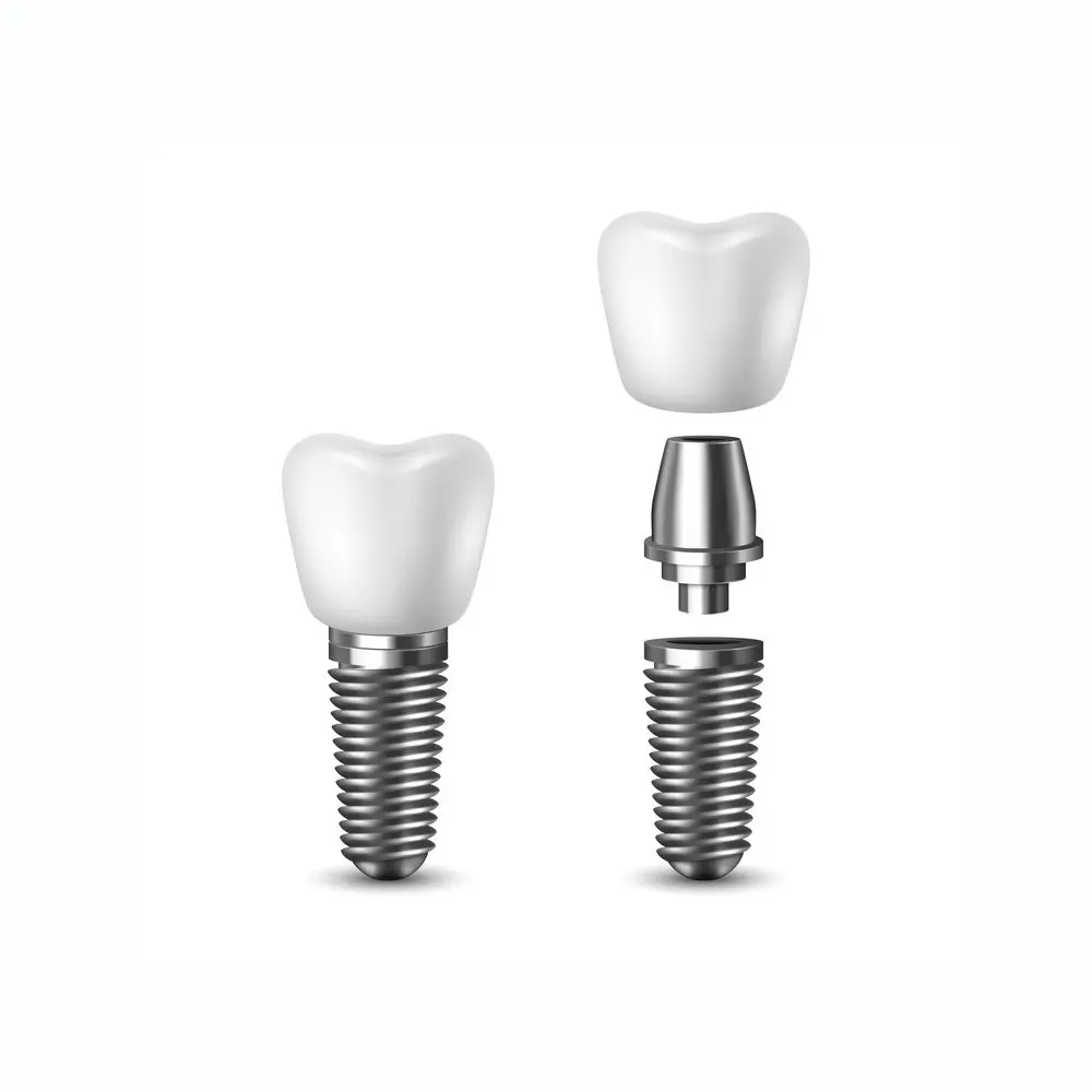 single tooth implant